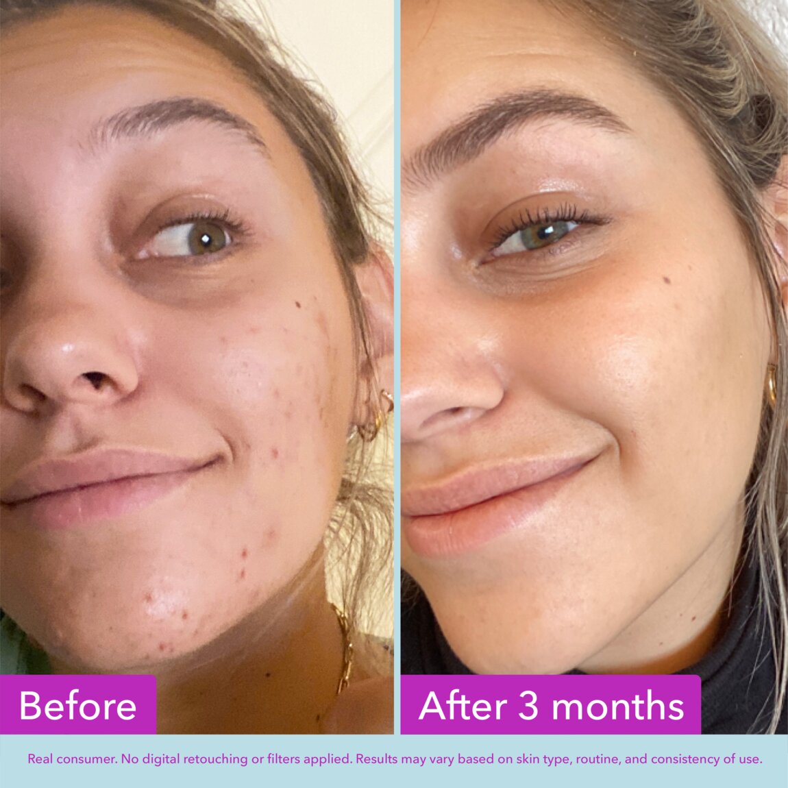 niacinamide-brightening-toner-e3 zb_p.jpg