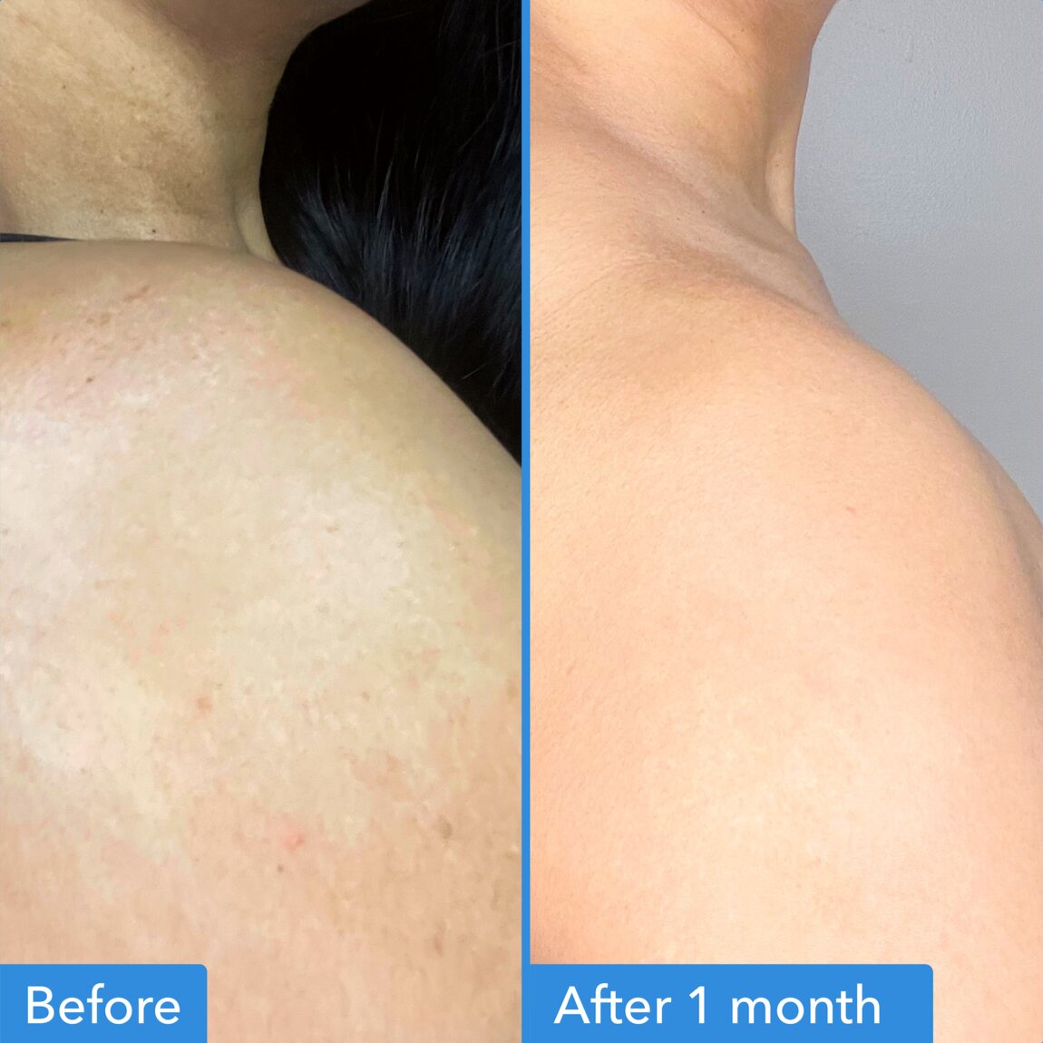 discoloration-correcting-body-treatment-h3 zb_p.jpg