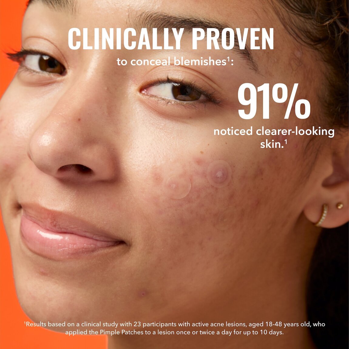 pimple-patches-v0 zb_p.jpg